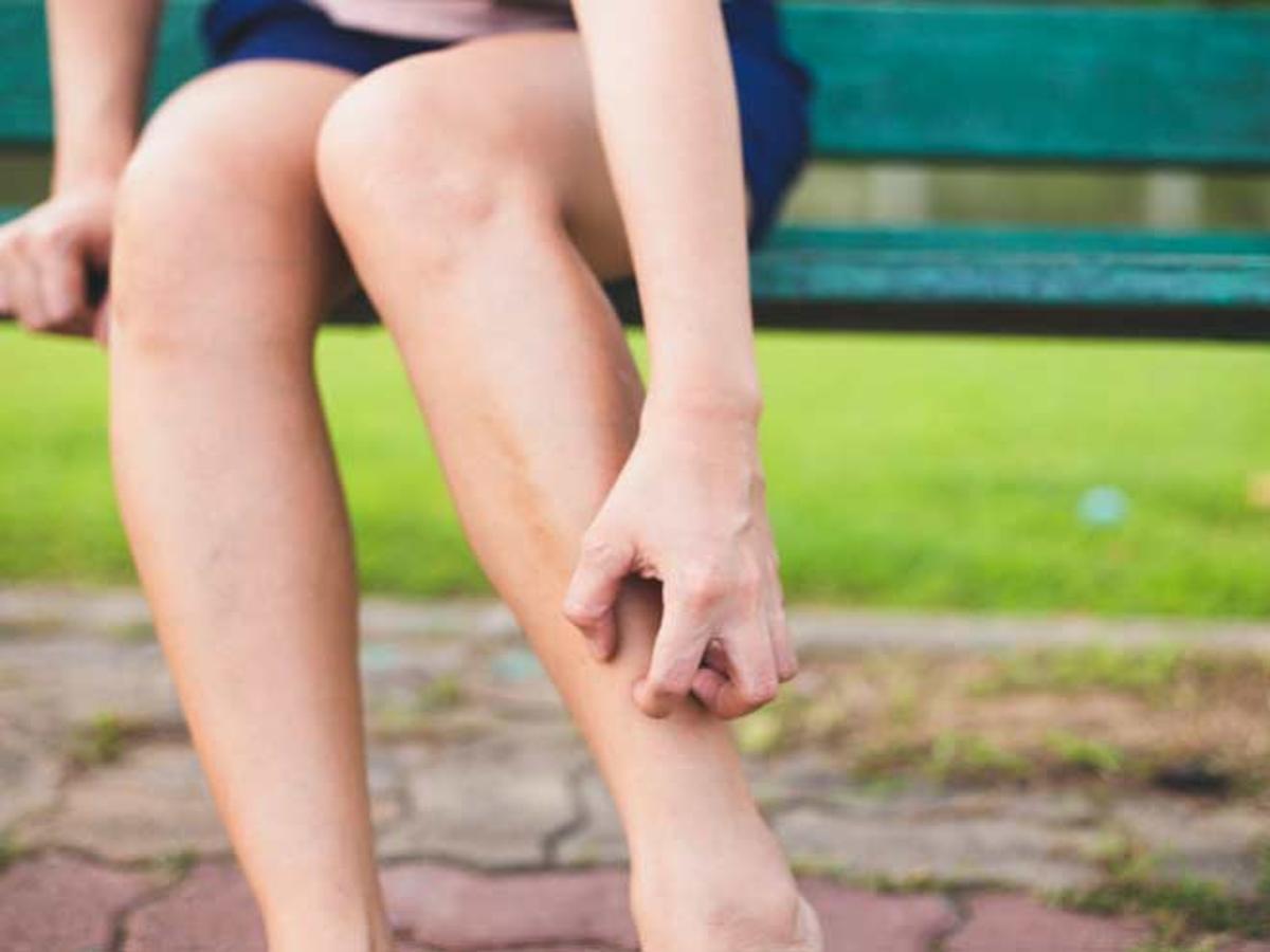 Dry Skin on Legs: How to Treat Dryness - snowyskinco