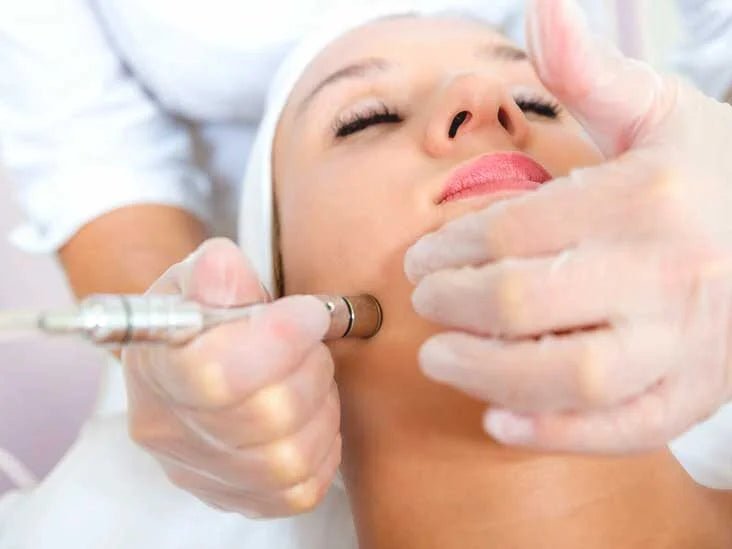 What is the Difference Between Microdermabrasion and Diamond Microdermabrasion? - snowyskinco